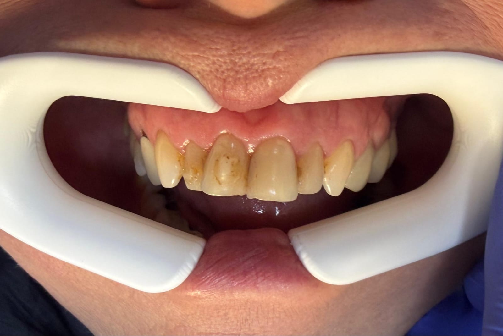Estética Dental Premium